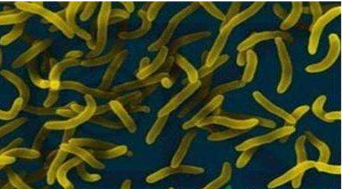 微生物菌劑好？好在哪里您知道嗎？